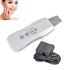 Mr097wq Ultrasonic Stainless Steel High Efficiency Skin Blackhead Removal 0190891279996
